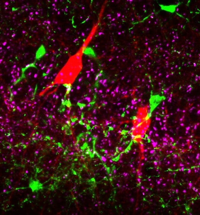 A mikroglia sejtek (zöld) az idegsejtek (piros) és a szinapszisok (magenta) hihetetlenül komplex neuro-immun hálózatot alkotnak az agyban