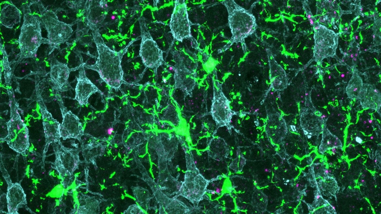 Mit tehet a kutatás az idegrendszeri betegségek gyógyításáért?